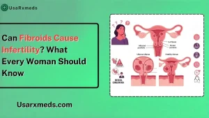 Can Fibroids Cause Infertility