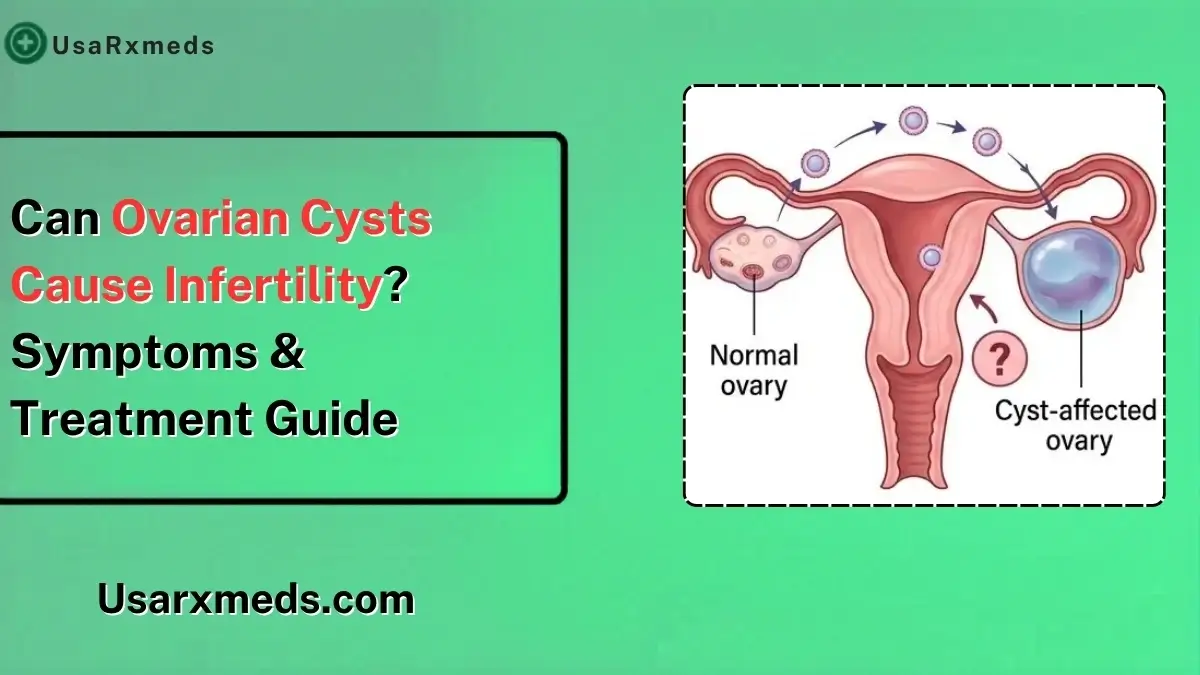 Can Ovarian Cysts Cause Infertility? Symptoms & Treatment Guide